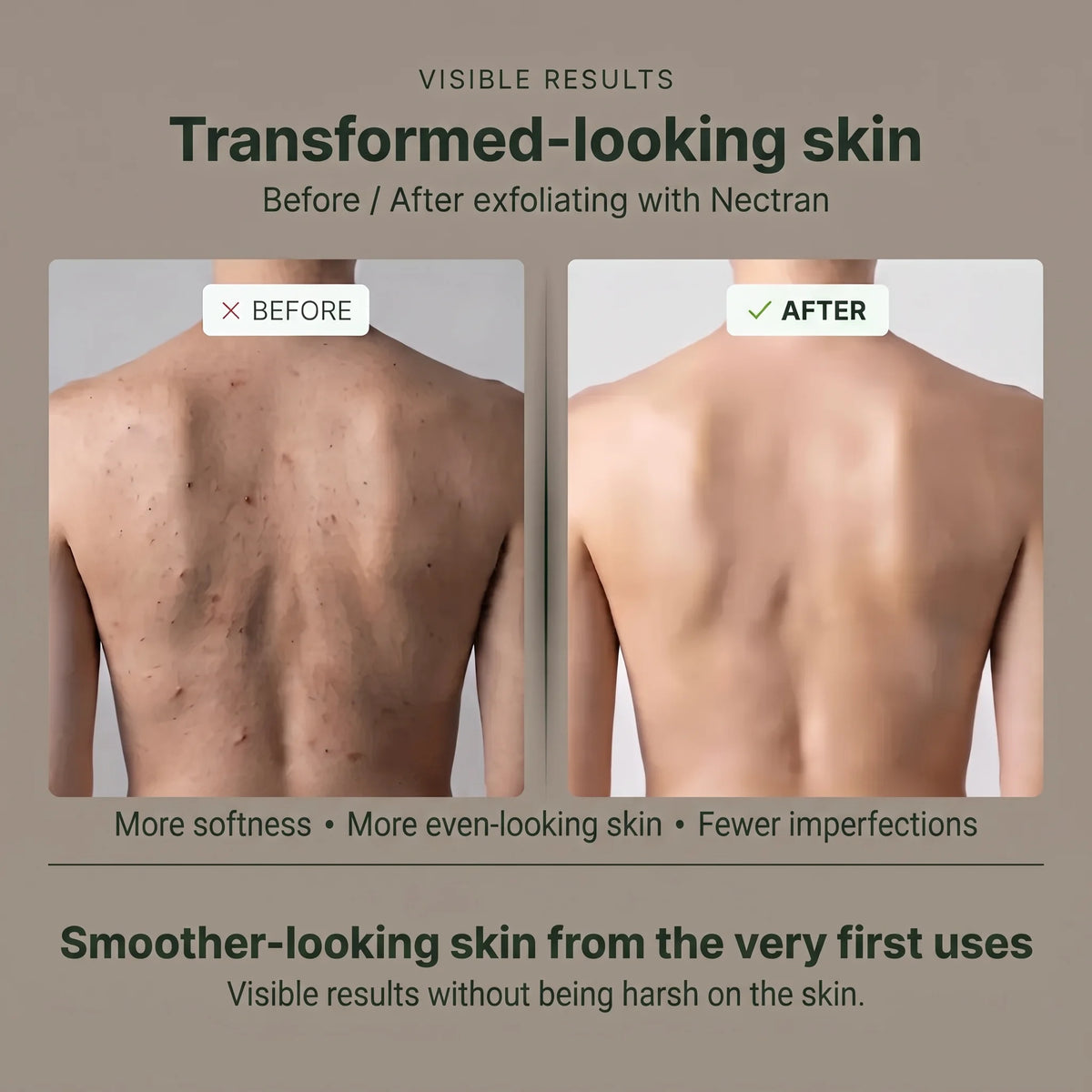 Eskano™ - Nectran Exfoliating Shower Towel